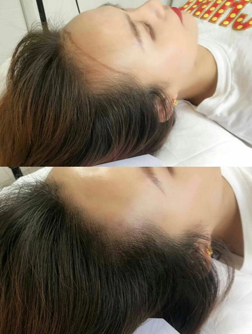 Signature Hair Line 独家发际线